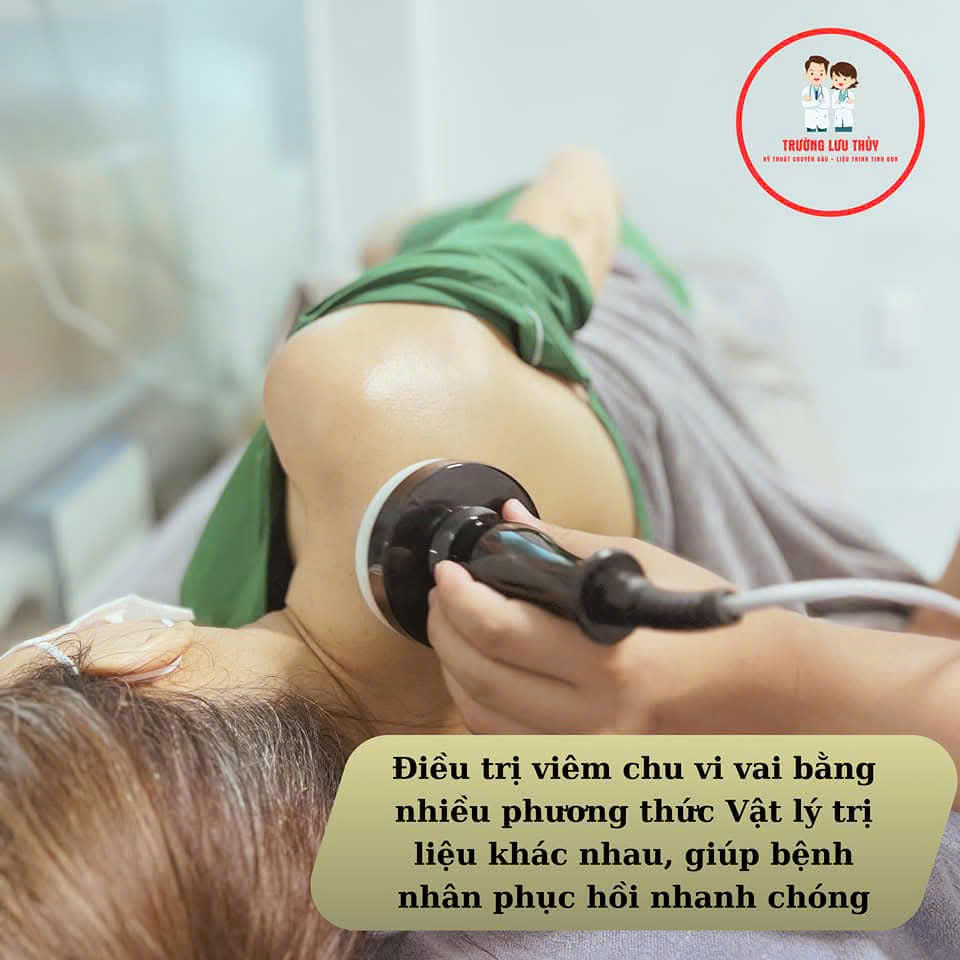 Viêm chu vi vai và phương pháp điều trị